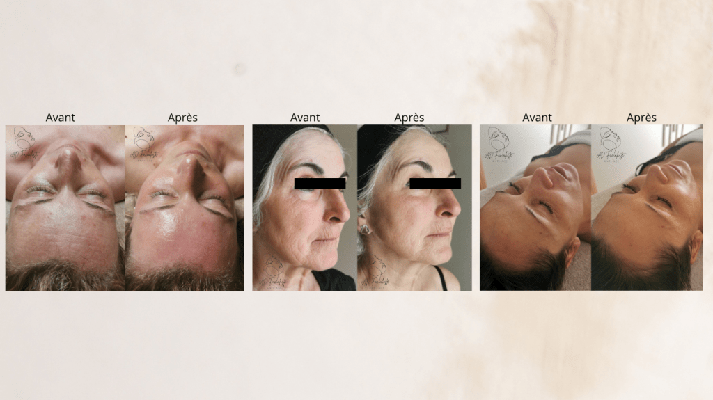 Kobido à Tresques, proche de Laudun et Rochefort-du-Gard